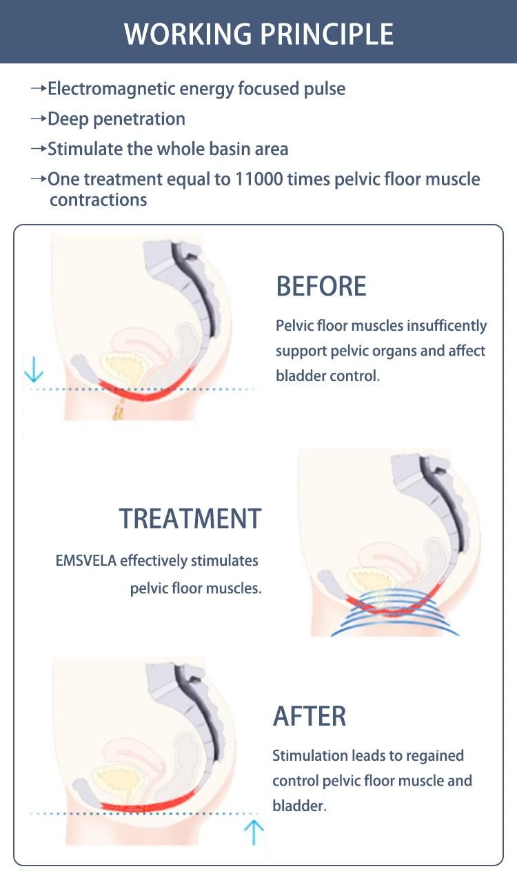 EMS Chair Pelvic Floor Muscle Building Hiemtsure Machine EMS