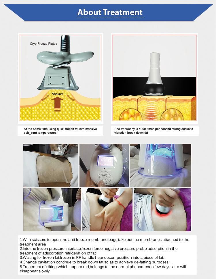 New Fat Freeze System Beauty Equipment Body Slimming Cryolipolysis Technology Beauty Machine