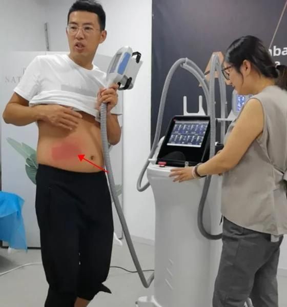 Cryolipolysis Machine Fat Freezing Slimming Machine Cryolipolysis Loosing Weight Beauty Machine