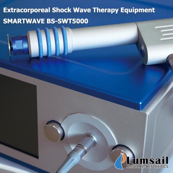 Shockwave Therapy (Eswt) Patellar Tendinitis Calcific Tendinitis of The Shoulder