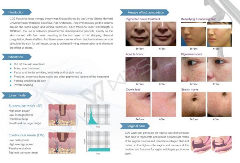 CO2 Laser Skin Resurfacing Vagina Tightening Private Shaping Beauty Machine