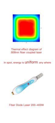 400W Fiber Diode Laser Hair Removal with High Efficiency and Uniformity