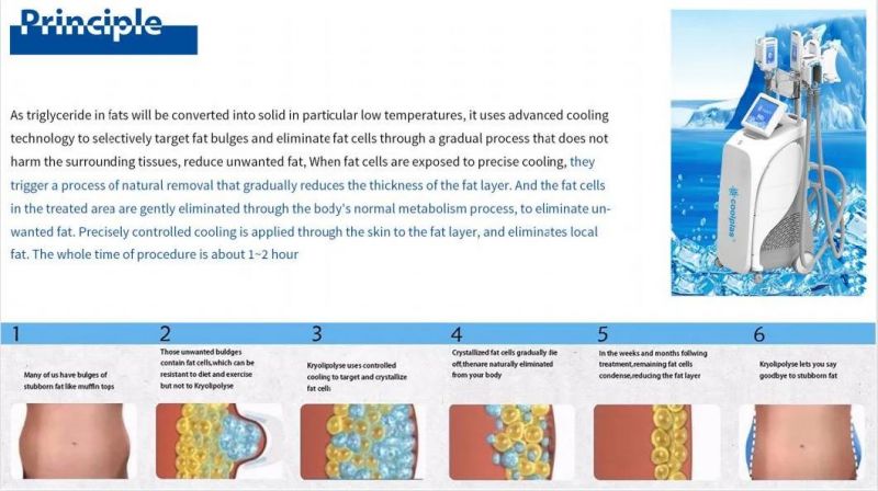 Top Quality Cryo Cryolipolysis Machine 4 Handles Coolplas Machine with Double Chin Treatment for Fat Losing