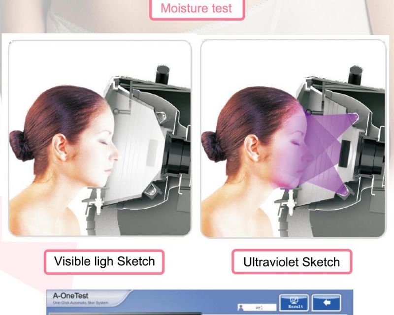 Portable Digital Facial Skin Analyzer for Acne Removal (CE approval)