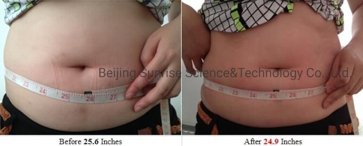 Sunrise 2022 Lipo Laser 5D Lipo Melt Laser Slimming Machine Lipo Laser Fast Slim Machine 5D Lipo Laser Machine