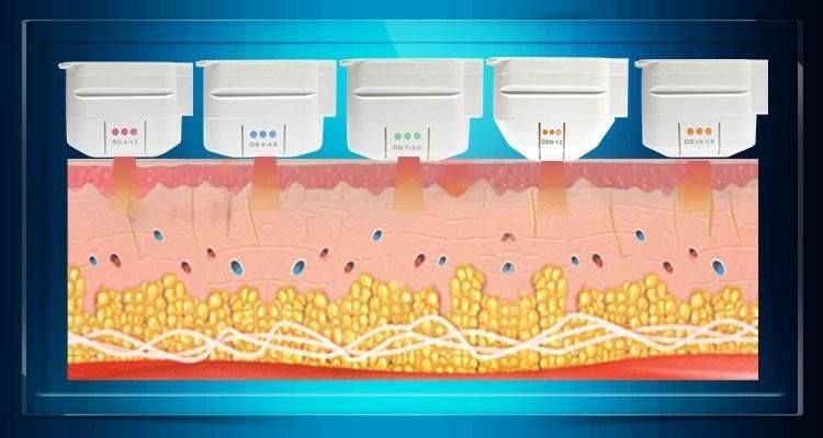 Smooth Coarse Pore Intensity Focused Ultrasound Hifu Machine