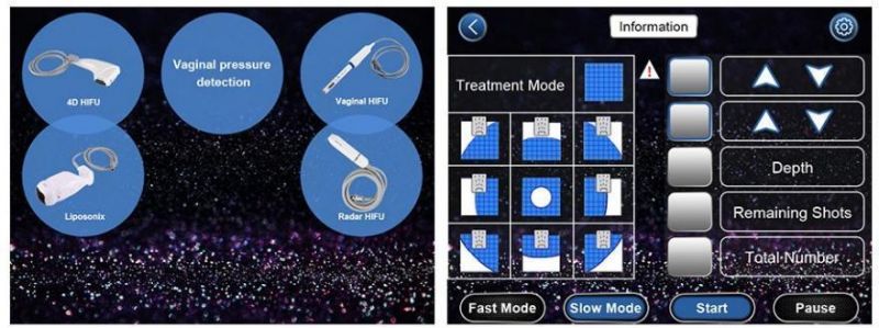 9d High Intensity Focused Ulrasound, Radar Higu, Liposonic, Hifu Machine