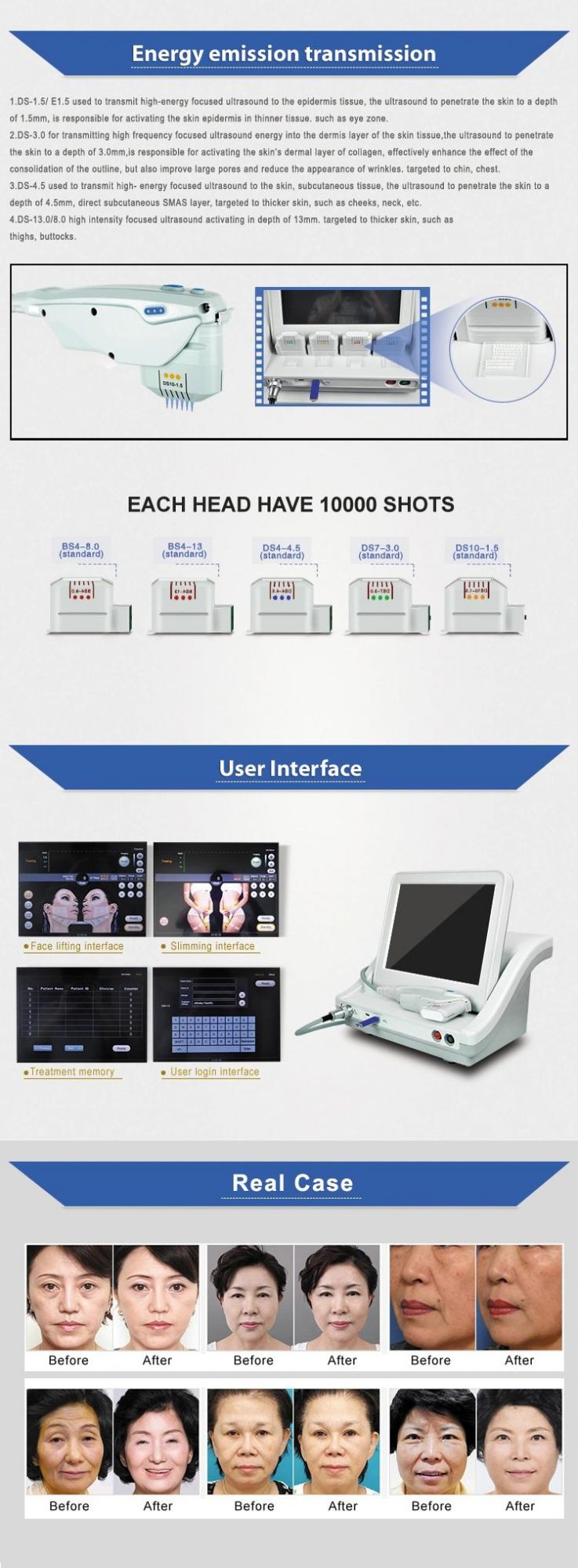 High Intensity Wrinkle Removal Face Facial Lifting Ultrasound Hifu Machine