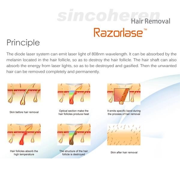 FDA Approved Medical Dildo Hair Removal Laser Razorlase for Permanent Hair Removal