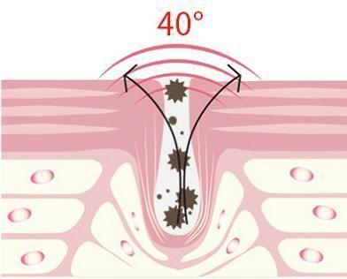 Ice Sensation Soothing Eye Massage Stick Vibration Lifting Wrinkle Remove Thermal Eye Care Massager