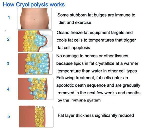 Professional Cryolipolysis Fat Freezing Cryotherapy Cryoliplysis Adipose Freezing / Cryolipolysi Slimming Machine / Criolipolisis for Fat Reduction