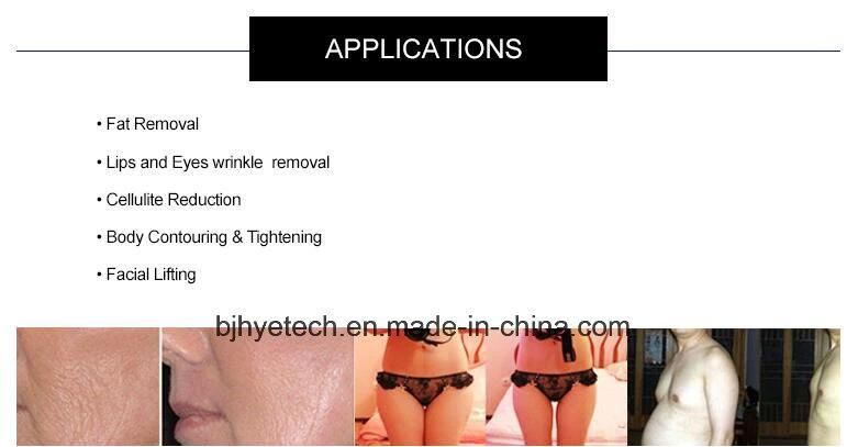 Cellulite Removal Cryotherapy Body Slimming Lipo Cavitation Laser Equipment