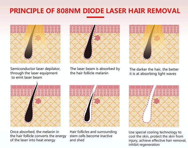 Titanium Diode Laser Triple Wavelength Rano 755 808 1064 Machine