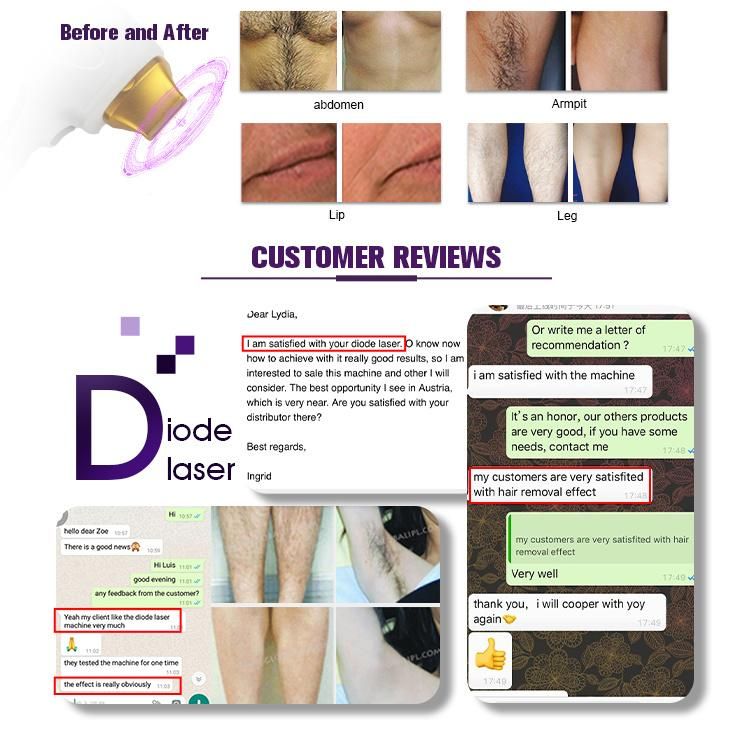 Permanent 808nm Diode Laser Hair Removal Machine