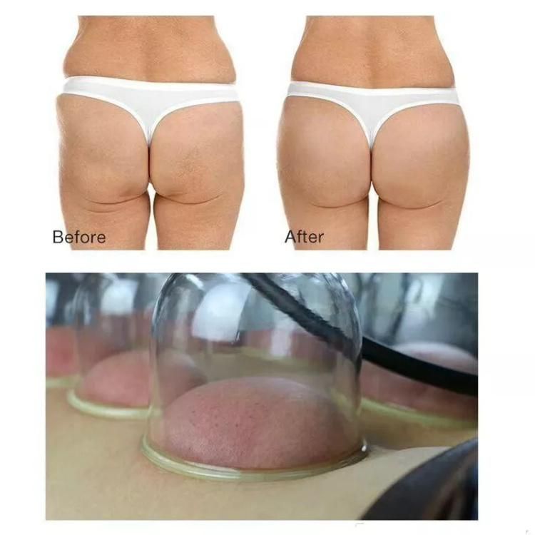 2022 New Vacuum Therapy Machine for Breast Butt Lifting Breast Enhance Cellulite Treatment Cupping Device