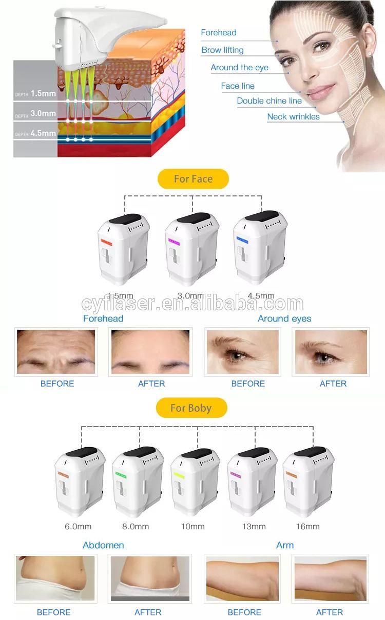 2022 Popular 4D Multi-Line Hifu Anti-Aging Beauty Instrument for Sale