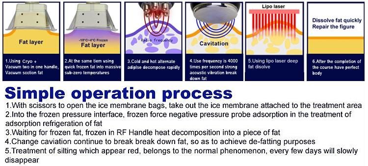 Laser Body Slimming Machine--Cryolypolysis Fat Freezing