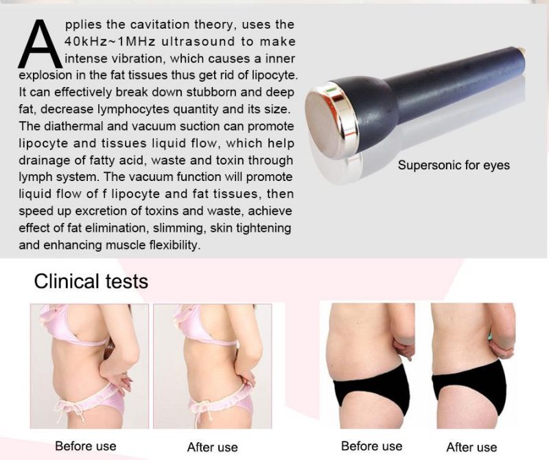 Supersonic and Ultrasonic Fat Reduction Body Slimming Equipment