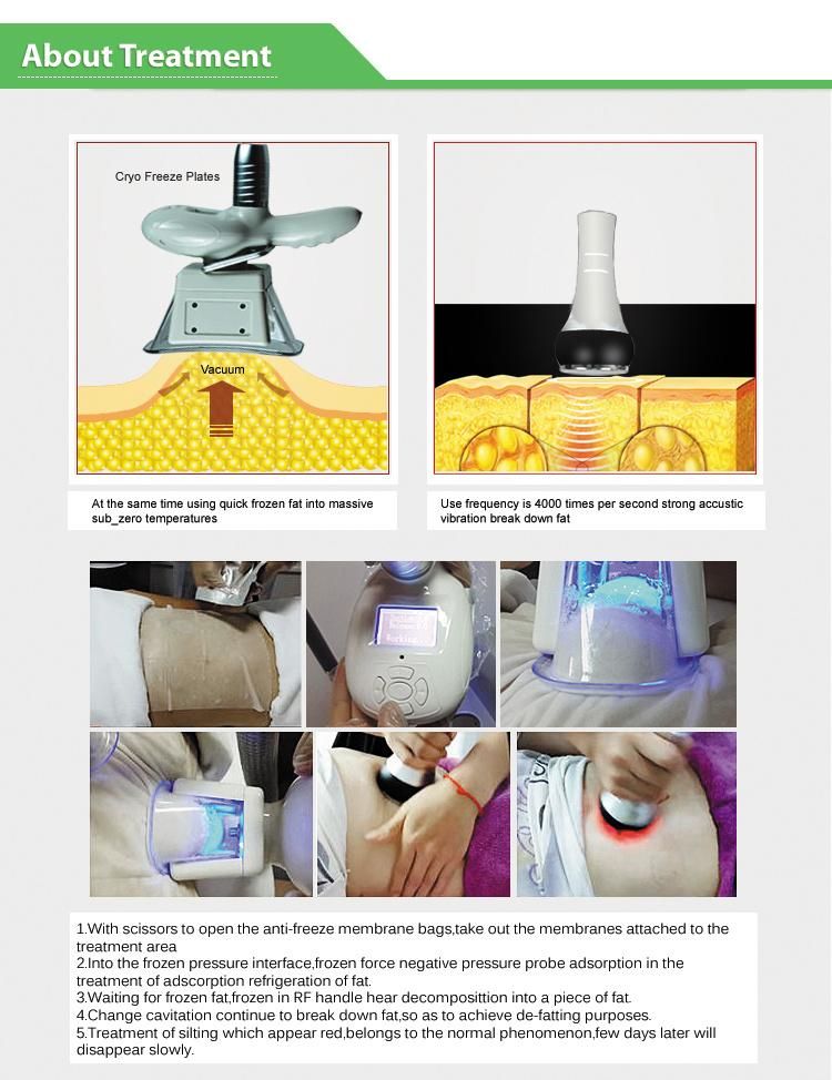 Fat Freezing Slimming Cryolipolysis Cool Shaping Machine for Fat Removal