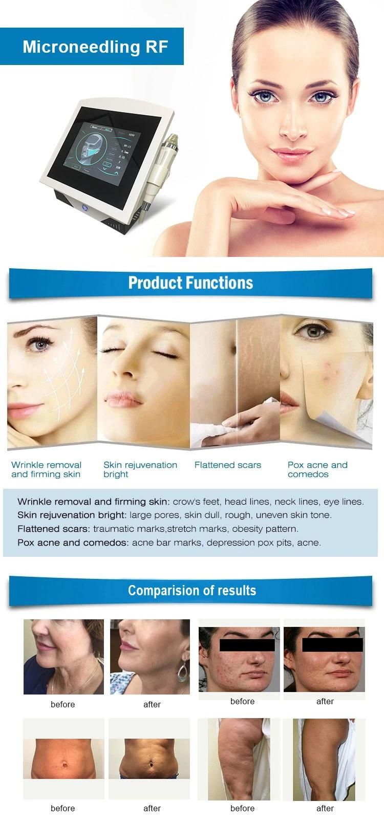 Sincoheren Microneedle Wrinkle Removal Machine RF Thermagic Skin Care