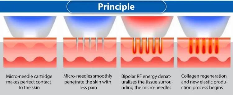 Microneedling Skin Rejuvenation Fractional RF Microneedle Machine