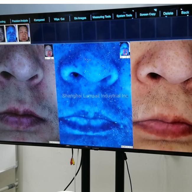 3D Magic Mirror Facial Skin Analyzer