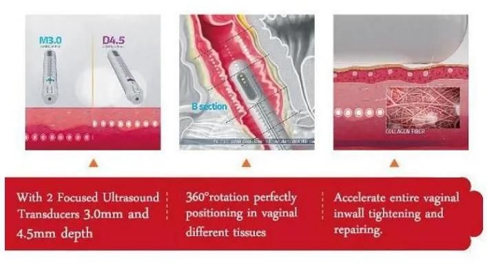 4 Handpieces for Antiaging 4D Hifu