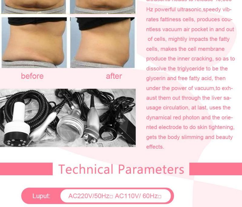 Multipolar Radio Frequency Cavitation Slimming Beauty Equipment