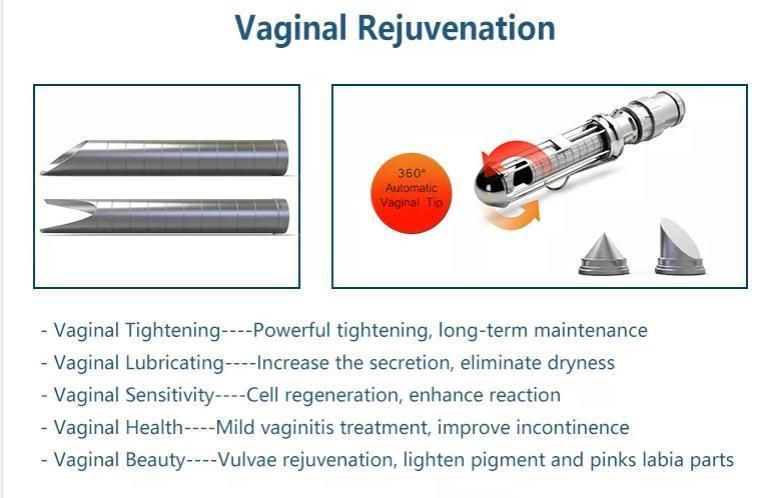 Beauty Machine Scar Removal Fractional Skin Resurfacing 1064nm ND YAG Laser Fotona 4D PRO Laser 4D Fotona Laser for Face Beauty Device Fotona Laser