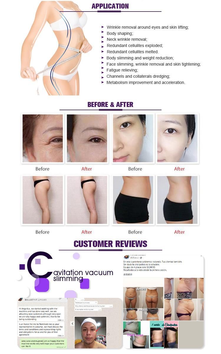 Ultra Face Lifting Quiet Cavitation Fat and Cellulite Removal Machine