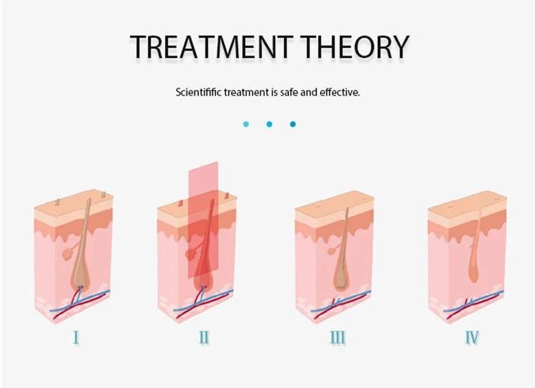 The High Configuration Shr+IPL+RF+E-Light Hair Removal Equipment