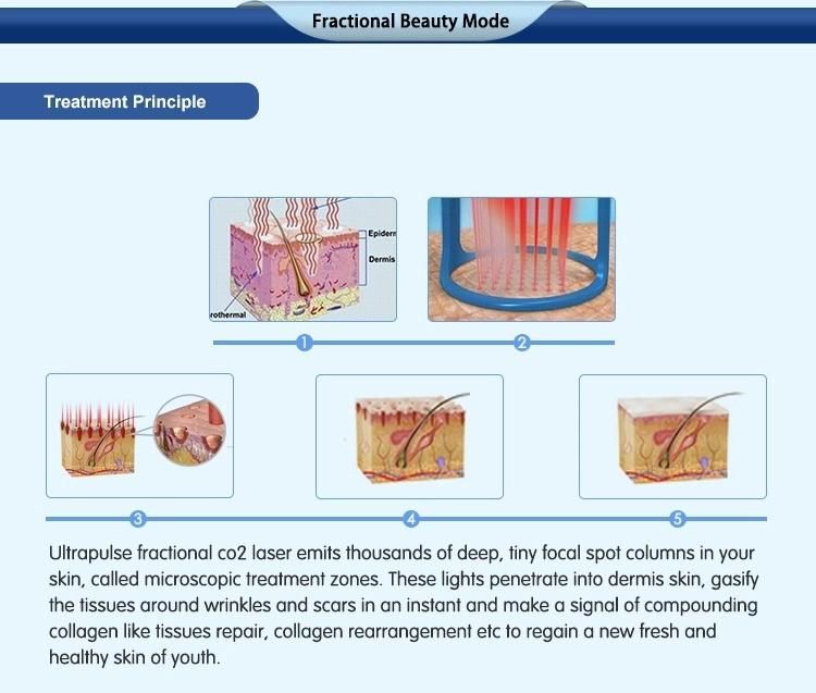 Laser Medical Equipment Scar Removal Machine Laser