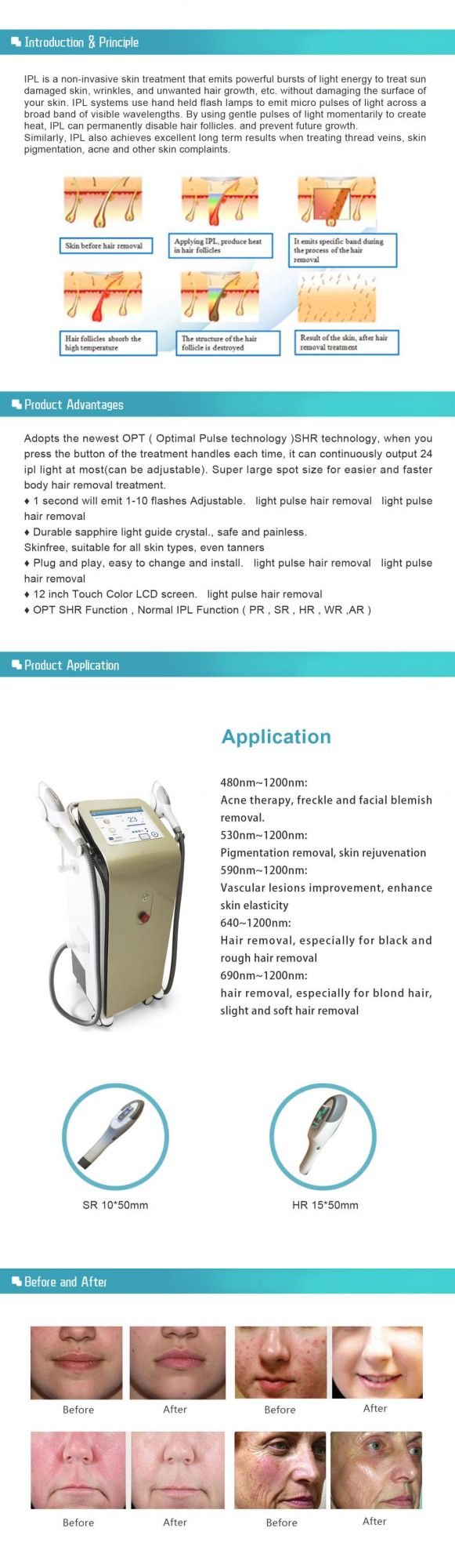 Vertical Two Handles Opt Machine Fast Hair Removal Opt Shr