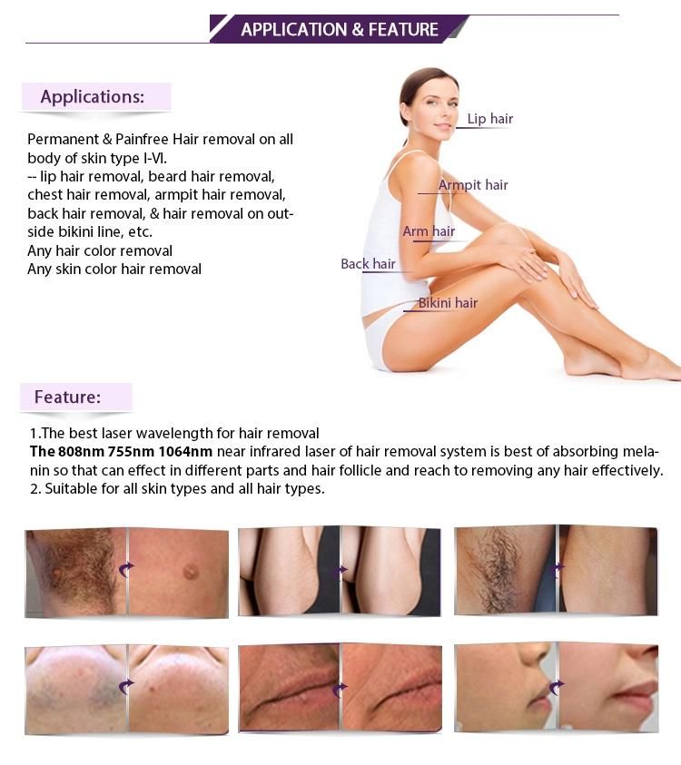 Permanent Diode Hair Removal Laser Machine