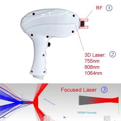 755+808+1064nm 3D Focused Laser Module Diode Laser Hair Removal