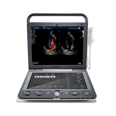 Sonoscape S9 Medical Echography Portable Ultrasound Machine 3D 4D