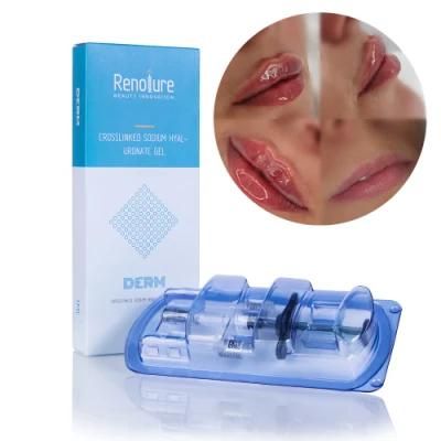 Renolure Injectable Facial Hyaluronic Acid Dermal Filler for Face/Nose/Mouth Injection