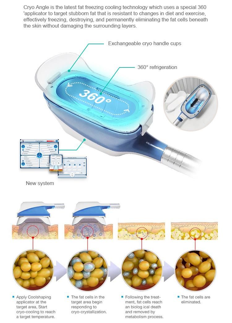 Portable RF Cavitation Lipo Laser Cryo Fat Freezing 360 Cryolipolysis Fat Removal Treatment