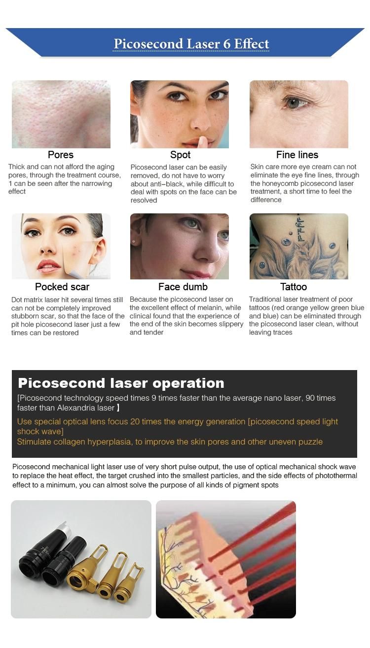 Portable Picosecond Laser Machine for Birthmark Freckle /Tattoo Pigment Removal