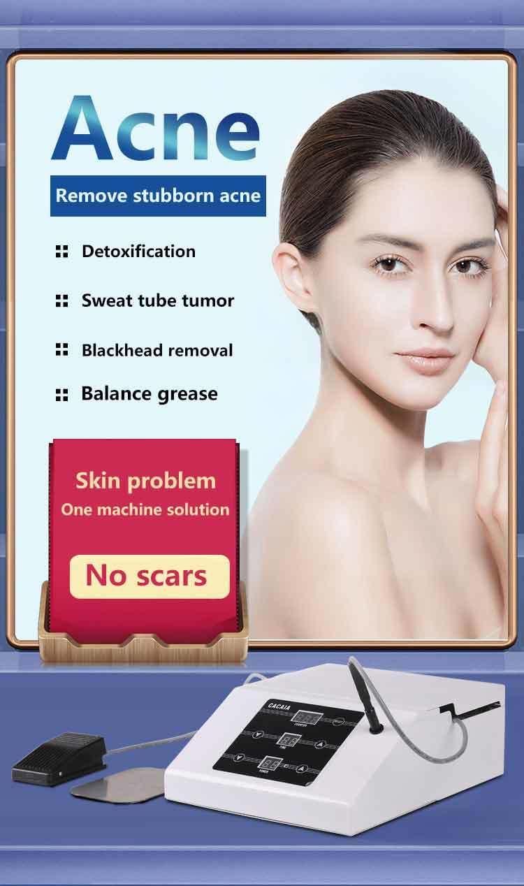 Portable Insulation RF Acne Removal Face Care Machine