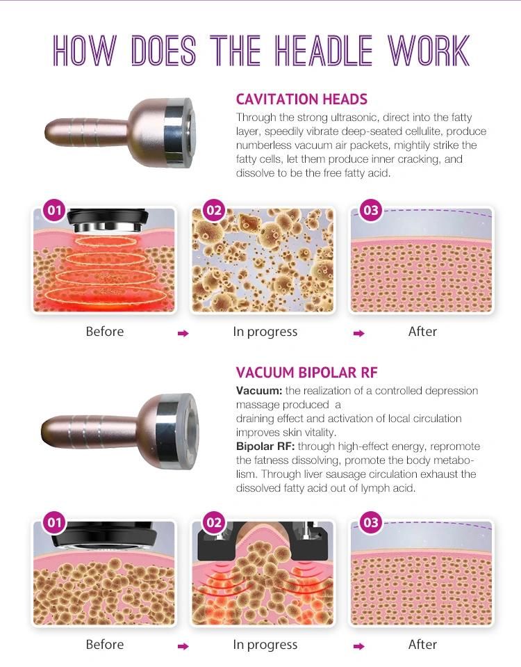 Skin Tightening Cellulite Reduction Clinic vacuum Freezing Fat Cavitation Machine