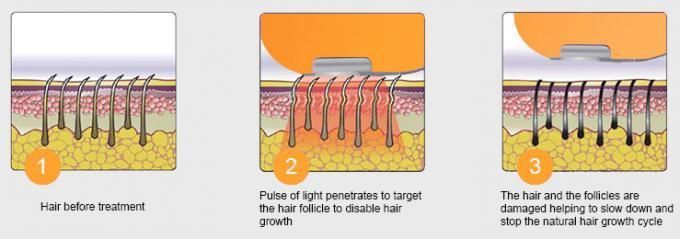 Multi-Functional Ice IPL Laser Skin Whitening Pore Shrink IPL Hair Removal Skin Rejuvenation