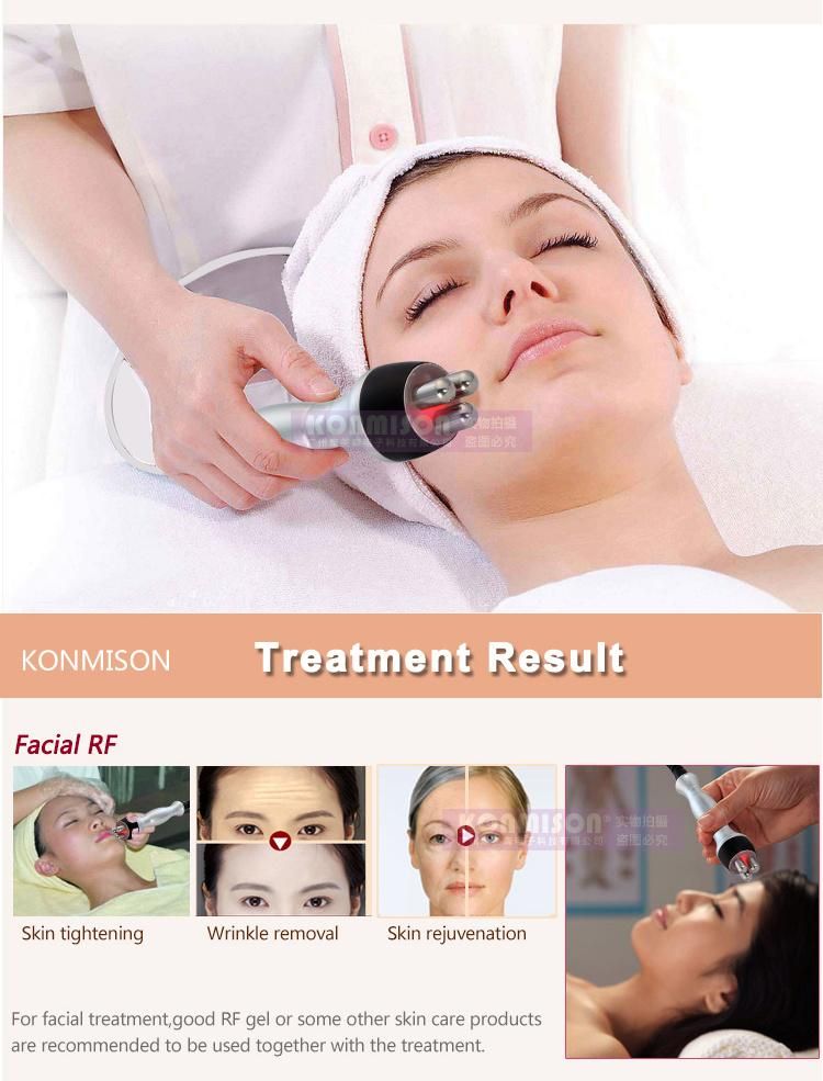 RF Beauty Machine Portable for Home Use Tripolar Radio Frequency Face Lifting Skin Tightening RF Beauty Equipment