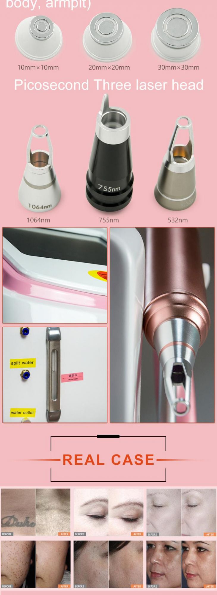 3 in 1 RF Shr IPL Laser Permanent Hair Removal Machine Price