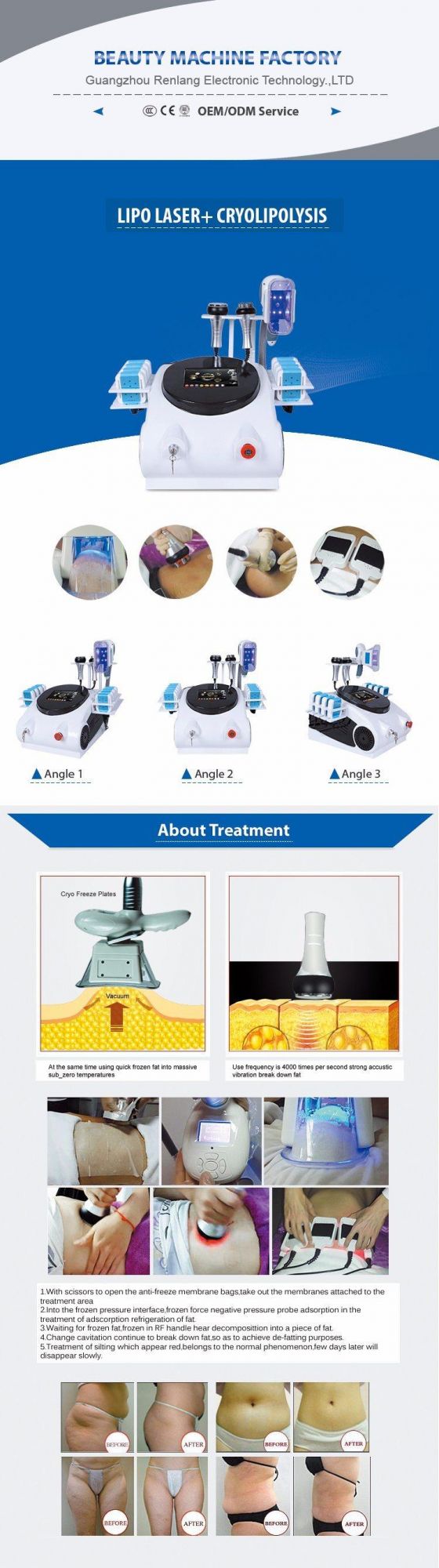 Best Selling 4 in 1 Cryolipolysis Fat Freezing Slimming Machine