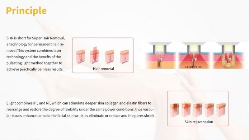 Consultant Be IPL Permanent Laser Hair Removal Home Venus 2000 IPL Hair Removal Device