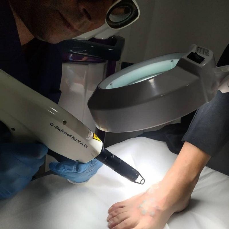 QS ND YAG Equipment CE Medical Approved YAG Laser Skin Resufracing Beauty Machine (HS-220E+)