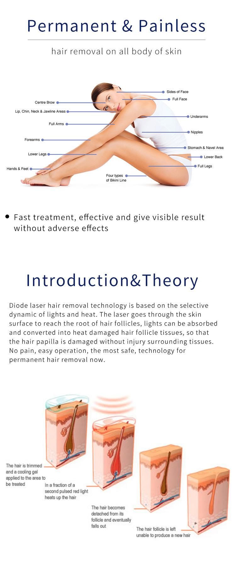 Depilation Permanent Hair Removal for Salon Hair Removal Diode Laser