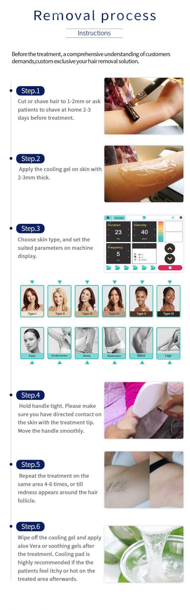 High Powerdiode Laser Hair Removal Machine 3 Wavelength 755/808/1064nm