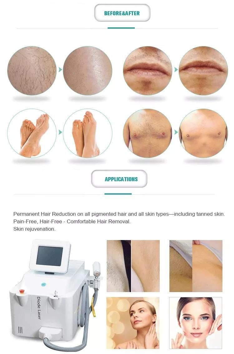 Germany Jenoptik Bars Painless Portable 808nm Diode Laser Hair Removal Machine